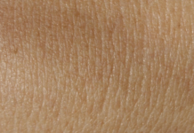 Questions/réponses : Une peau moins luisante Questions/réponses : Une peau moins luisante