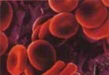 Dans l’ombre de la drépanocytose Dans l’ombre de la drépanocytose