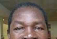 Burkina Faso : réinsérer les lépreux dans le tissu socio-économique Burkina Faso : réinsérer les lépreux dans le tissu socio-économique