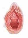 Hymen après pénétration Hymen après pénétration