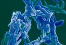 Botswana : détection d’une souche de tuberculose extrêmement dangereuse Botswana : détection d’une souche de tuberculose extrêmement dangereuse