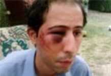 Agression dans les Yvelines : des « nazis » s’en prennent à un musulman Agression dans les Yvelines : des « nazis » s’en prennent à un musulman