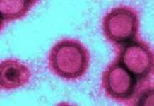 La grippe H1N1 se répand en Afrique de l’Est
