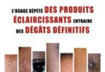 La mairie de Paris en croisade contre la dépigmentation