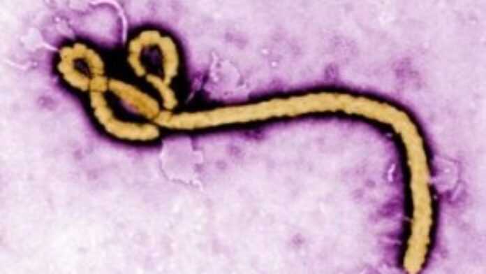 Virus Ébola (au microscope électronique) montrant la structure filamenteuse de la particule virale.