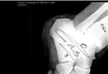 JOURNEE MONDIALE DE LUTTE CONTRE LE VIH/Sida (1er décembre), PLUSIEURS CHAMPIONS SE FONT RADIOGRAPHIER POUR L’AFRIQUE JOURNEE MONDIALE DE LUTTE CONTRE LE VIH/Sida (1er décembre), PLUSIEURS CHAMPIONS SE FONT RADIOGRAPHIER POUR L’AFRIQUE