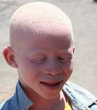 arton22047