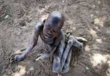 Ouganda : la mystérieuse « maladie du tremblement » tue toujours Ouganda : la mystérieuse « maladie du tremblement » tue toujours