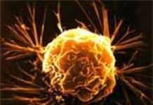 Algérie : le cancer fait des ravages chez les jeunes Algérie : le cancer fait des ravages chez les jeunes