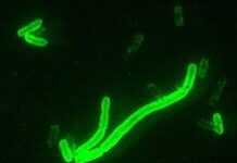 Madagascar : la peste gagne du terrain Madagascar : la peste gagne du terrain