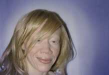 Adrienne Ntankeu:  «J’ai été frappée par les conditions de vie des albinos au Cameroun»