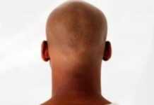Bientôt un remède contre la calvitie Bientôt un remède contre la calvitie