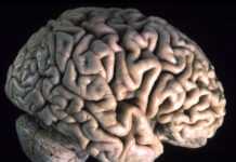 Trois personnes meurent d’une méningite foudroyante en deux jours Trois personnes meurent d’une méningite foudroyante en deux jours