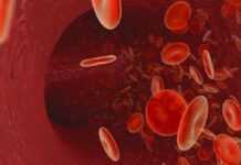 Quand un virus modifié de la rougeole guérit un cancer du sang !