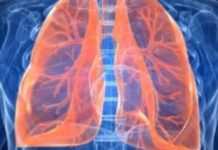 Les embolies pulmonaires en forte baisse après la crise des pilules !
