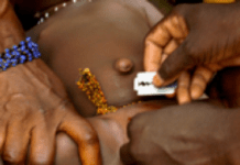 Mutilations génitales : la Guinée championne de l’excision ! Mutilations génitales : la Guinée championne de l’excision !
