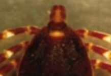 Sénégal : Confirmation d’un cas de fièvre hémorragique de Crimée-Congo Sénégal : Confirmation d’un cas de fièvre hémorragique de Crimée-Congo