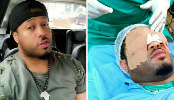 Nigeria : la star de Nollywood Mike Ezuruonye se fait opérer des yeux