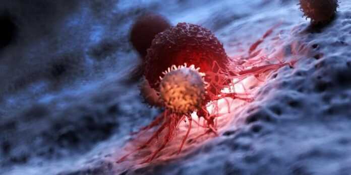 cancer