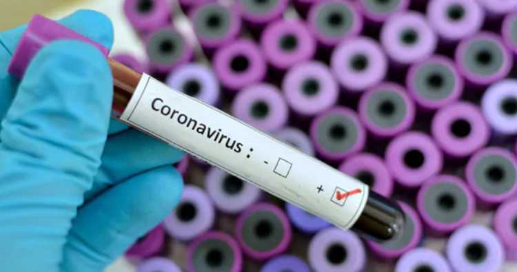 Un Sénégalais atteint de Coronavirus : fin du mythe Noir !