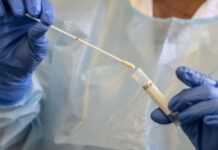 Coronavirus, Sénégal : record de 87 cas positifs en 24h, 1 cas communautaire infecte 25 contacts Coronavirus, Sénégal : record de 87 cas positifs en 24h, 1 cas communautaire infecte 25 contacts