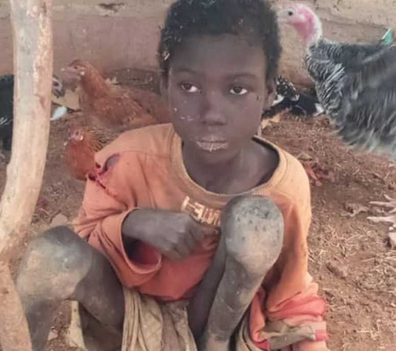 Nigeria : un enfant de 10 ans enchaîné pendant deux ans avec des animaux, par sa marâtre