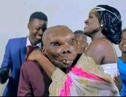 Ouganda : « L'homme le plus laid » convole en justes noces avec une troisième femme