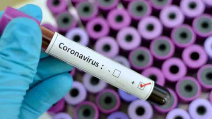 Test de Coronavirus