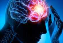 Maux de tête : ce régime qui vous débarrasse de vos migraines ! Mal de tête (23 nov 21)