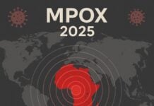 Mpox 2025