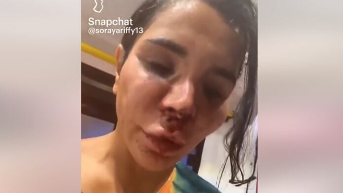 Soraya Riffy Soraya Riffy