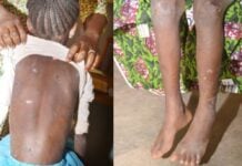 Maltraitance des enfants