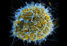 Contagion Ebola en RDC : des patients en fuite après l’attaque d’un centre de traitement en Ituri Virus Ebola